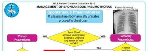 Behandling PSP: Klinisk stabil og første tilfelle: 3 cm: Gi O2 og observasjon >3 cm: aspirasjon (UL lokalisering mulig) Thoraxdren ved manglende effekt Tilbakevendende PSP eller hematpneumothorax: