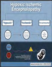 hypotension/hypovolemia Hypotension and cerebral hypoperfusion Gunn et al.