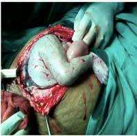 Obstetrics catastrophes What may contribute to brain damage?