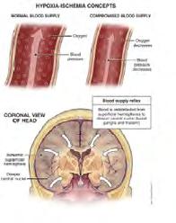 to take effect the kidney and liver functions are often intact after resuscitating surviving neonates h"p://ispub.