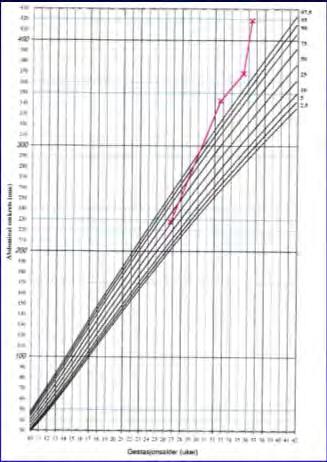 Her er det mange læringselementer, FOR ALLE! Kost og mosjonsråd ved starten av svangerskapet? ( BMI 35, og 13 kg vektøkning ved 24 uker!) Tidlig glukosebelastning?