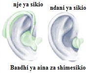 kabisa ni pale db zinapopindukia 90 (ambapo hutakiwa kusoma midomo au kutumia lugha ishara).