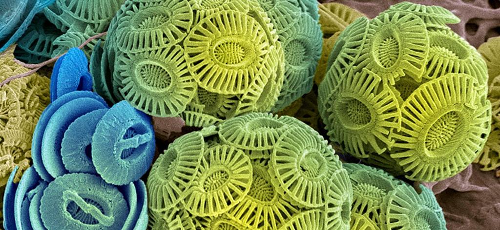 Dette er et kunstig farget elektronmikroskopbilde av kalkflagellater.