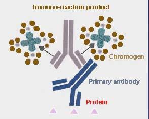 Detection of MPT64-antigen from the biopsies, aspirates, cell smears by