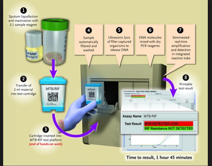 Xpert MTB/RIF assay Stor fremskritt Kassett-basert lukket sytem- ikke kontaminering Rask (2 t) Samtidig