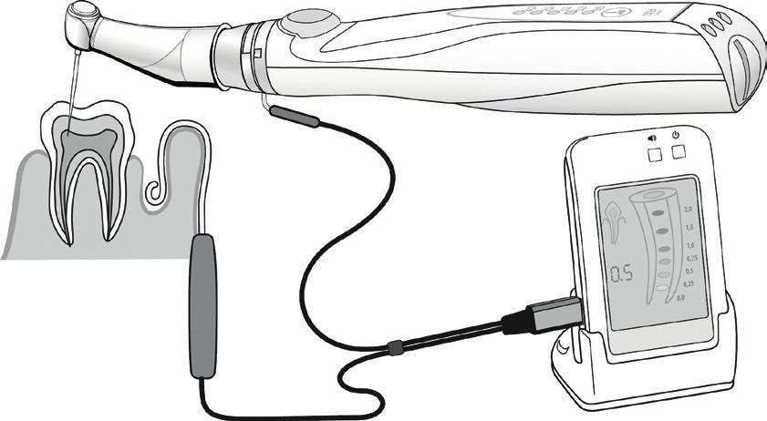 12. Koble instrumentet til et endometer Ved hjelp av S5 Endo-motorens S5 Apex-klemme kan en målekabel for et endometer kobles til S5 Endo-motorens vinkelstykke-enhet for å kontrollere den nøyaktige