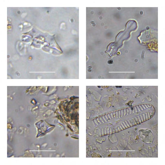 Figure 4: Micro- remains encountered on phytolith samples from Skulestadmoen