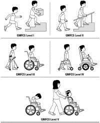 Gross Motor Function Classification System (GMFCS) CPOP 2017 GMFCS N=1415 I