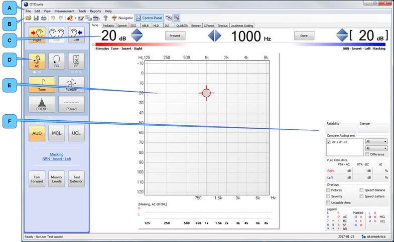 12 Utføre toneaudiometri Merk Hvis det er en forskjell på 10 db eller mer mellom benledningsterskelen og luftledningsterskelen for samme øre, kreves maskering.