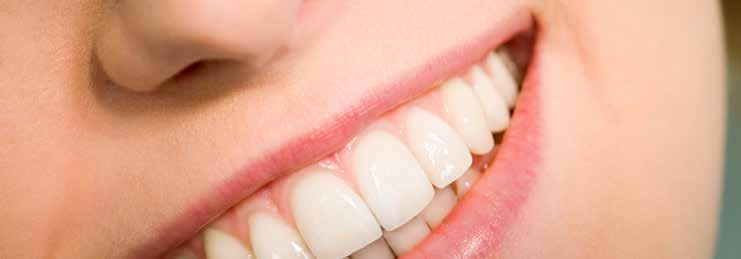 Forprosjekt Forebygging av tannerosjoner Tannerosjoner, også kalt syreskader, er en tannsykdom som oppstår på grunn av kjemisk slitasje av tannemaljen som ikke involverer bakterier.