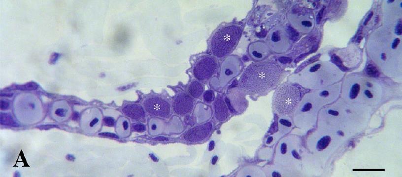 Bakterier Epitheliocystis Candidatus Branchiomonas cysticola Gill-chlamydia (Ca. P. salmonis, Ca. S. salmonis, Ca. C. salmonicola) Tenacibaculum spp.