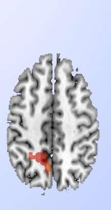 Cingulate self-control Superior parietal cognition/somatosensory processing Colorings