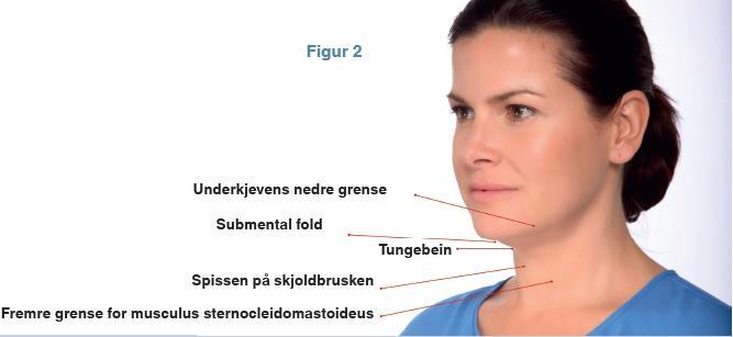 nedre grense dypt i platysma, men i forhold til