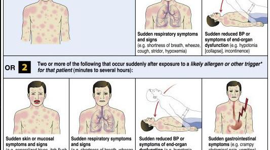 hud/slimhinne OG Minst en av: Respiratorisk