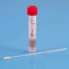 CMV diagnostikk spytt og urin Prøvetakning for påvisning av CMV i spytt hos nyfødte. Utstyr: Spatel.