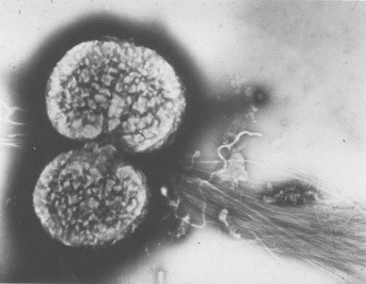 Side 34 av 41 Oppgave: MED1100-3_OPPGAVE4_H17_ORD Del 1: Oppgaver i mikrobiologi Spørsmål 1: En 2 år gammel pike blir innlagt med mistanke om hjernehinnebetennelse. Spinalvæsken blir tappet.