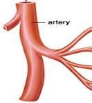 ischemic attack End-stage renal