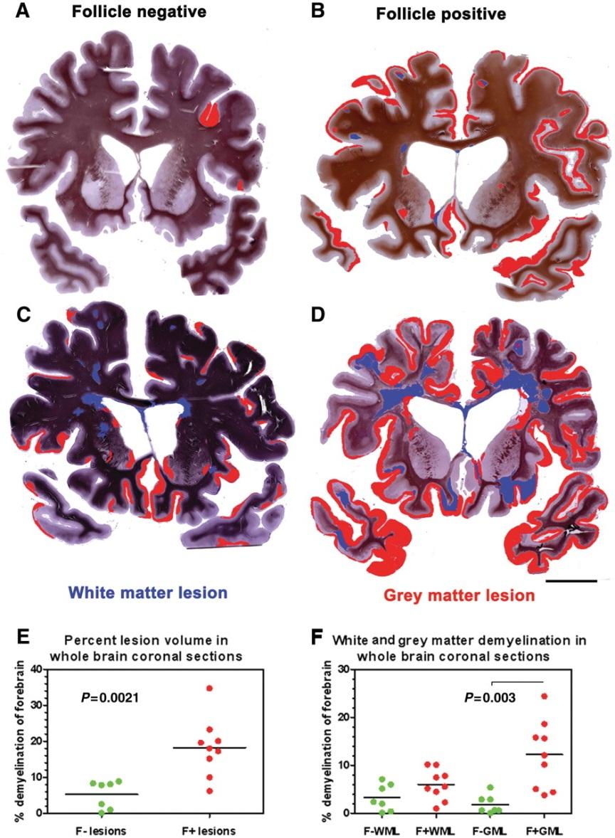 Howell OW et al.