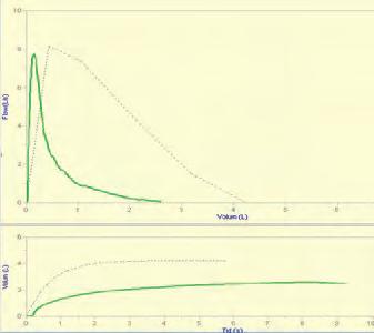 Spirometri viste FEV1/FVC 0,61, FEV1 64 % forventet, FVC 91 % forventet.