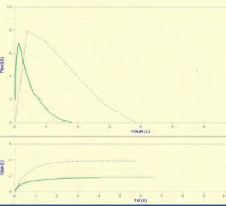 Hun fikk Prednisolon 30 mg i 10 dager, etter to uker var hun symptomfri, spirometri viste betydelig