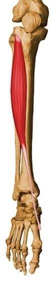 tibialis anterior overbelastet som følge av økt motkraft fra skoen, og ved harde yttersåler kan utløse en Shin splints, også kjent som medial tibial stress syndrom (MTSS).