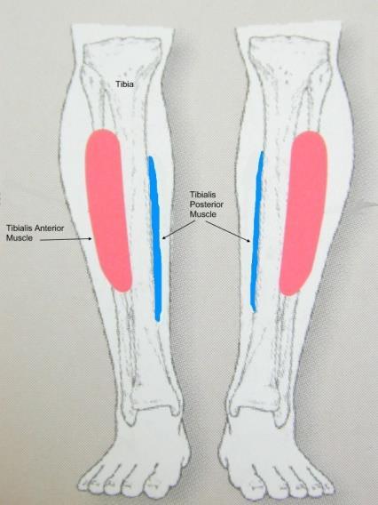 1 Tester og analyser Klinisk erfaring er at smertene kommer om kvelden/ natten. Flesteparten blir bedre i sine leggsmerter når de har ferie eller fritid. 8.1.1. Palpasjon langs Os tibia ventralt Palper langs facies lateralis på Os tibia.