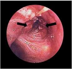 impulsoscillometri, wash-out, gass-diffusjon Diagnostiske hjelpemidler