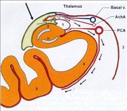 ikke-dominant side: visuospatial hukommelsestap Nevroner i hippokampus er sårbare for cellular metabolsk stress (på bakgrunn av hypoksi og iskemi) Sårbarheten kan relateres til