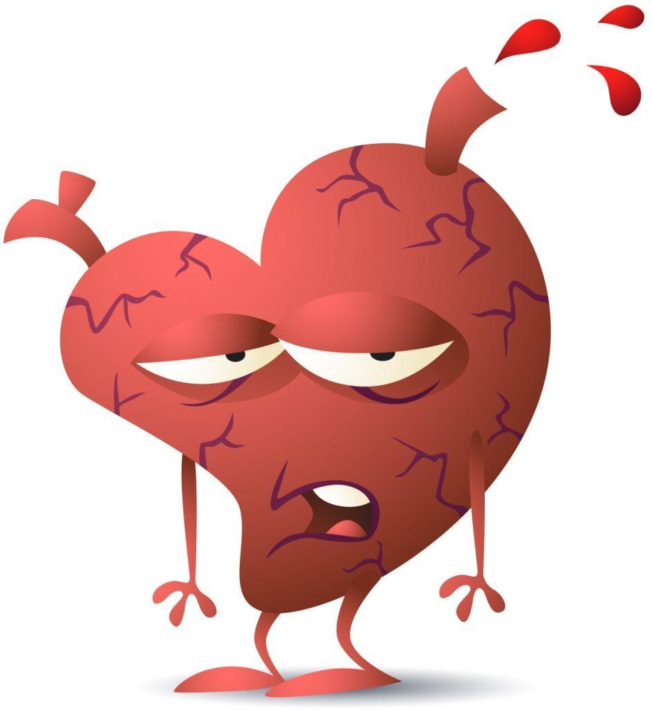 Hjertesvikt Definisjon, diagnose, årsaker og patofysiologi Peter