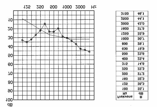 Priser eks. mva Mai 2008 for Lydreduserende Teleskopventil - art. 2400d lle verdier oppgitt ved 40cm veggtykkelse.