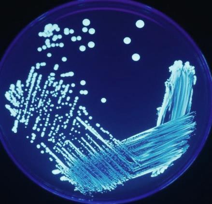 1. Introduksjon til Legionella Legionella er aerobiske gramnegative bakterier som forekommer naturlig i vann.