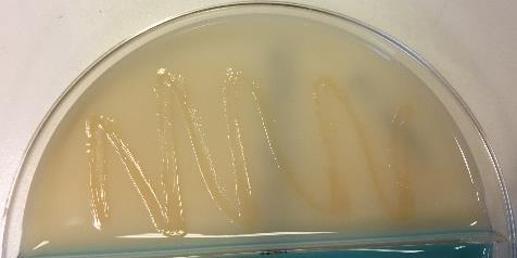 veksten sannsynligvis ikke er av ESBL-produserende Enterobacteriaceae.