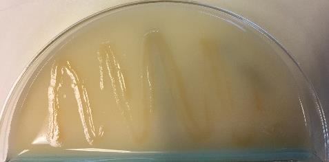 3 viser at det var vekst på alle skålene med medium som skulle selektere for ESBLproduserende bakterier.
