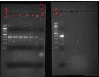 6.4.2 Screening med multipleks PCR og gelelektroforese av DNA i BHI-medium Gelbildet etter multipleks PCR av ekstraktene fra CRE-skåler viste ingenting, noe som for øvrig stemte overens med bildene