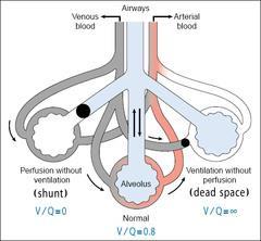 Dødrom Inspirert gass som når alveolene, men som ikke oksygenerer det blandede venøse blodet.