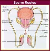 Post-testikulære årsaker - transport problem Manglende utvikling av sædleder (CF-pasienter) Hypospadi Uretrastrikturer Kirurgi Infeksjon (tbc, epididymitt) Dysfunksjonell aspermi Spinal skade Perifer