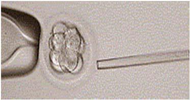 Klassisk (Inseminasjon) IUI av surrogat med fars sæd Barnet genetisk beslektet til far og surrogat Ved ART (Gestational) Embryo skapt