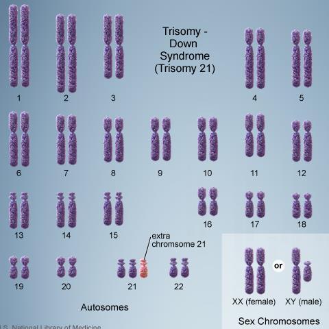 syndrom)(to X og en Y: Klinefelters syndrom) Triploidi (tre kopier av alle