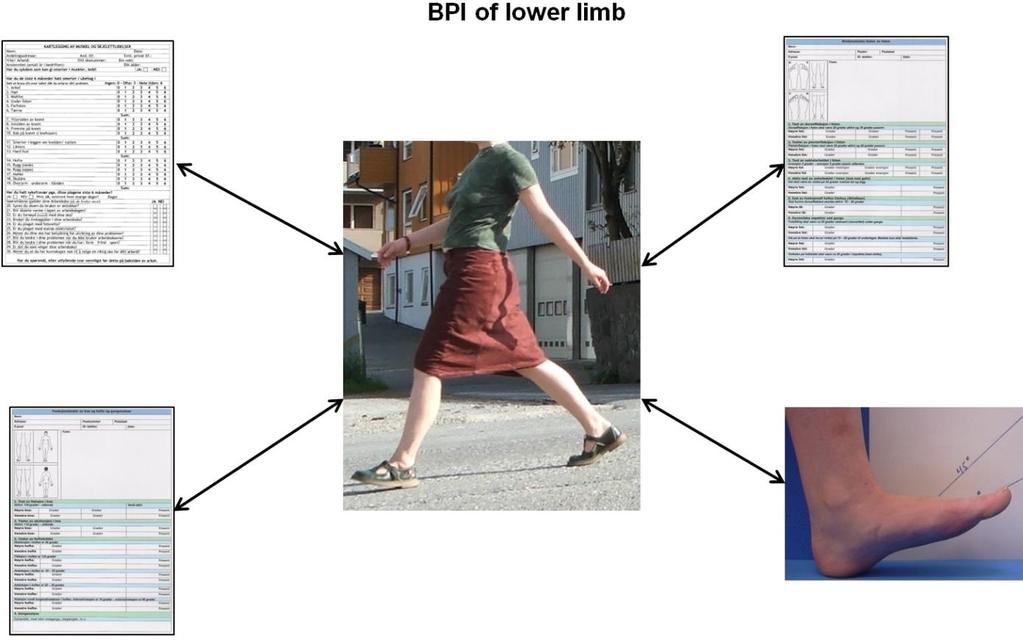 15.2 BPI (Biomechanical Point Index) Biomekanisk Poeng Index er en klassifiseringsmetode på status av fot, gange, problemer, og føringstest.