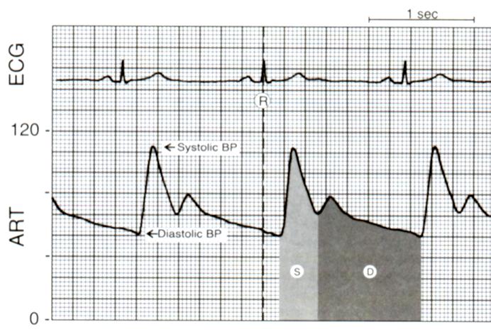 Arterielt