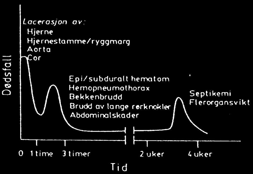 Trimodal