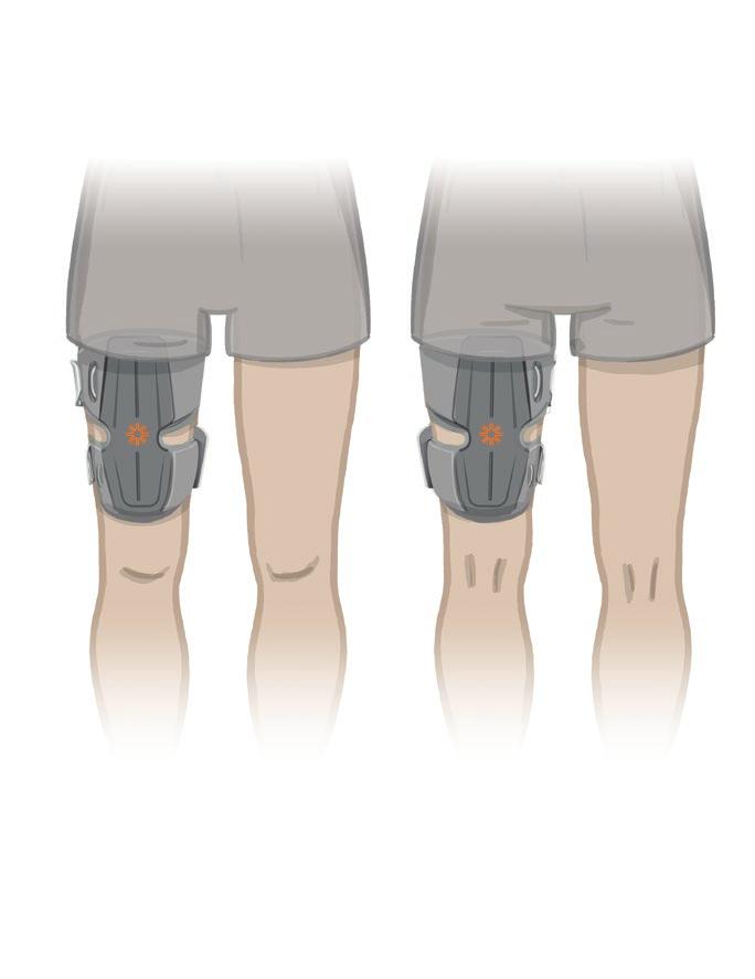 Figur 8-19: Riktig posisjon for FS-lårmansjetten (venstre) i quadricepstilpasningsposisjon, (høyre) i hamstringtilpasningsposisjon Teste FS-lårmansjettens posisjon: pasient sittende og stående Slik