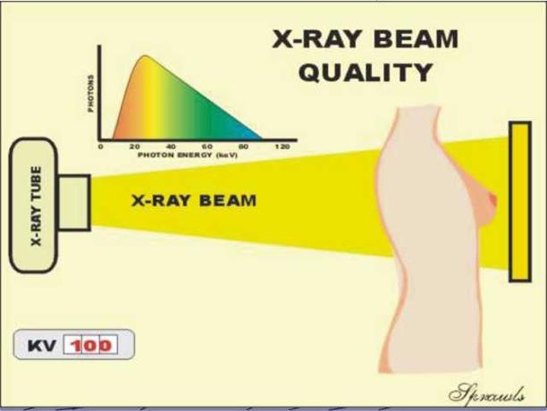 Røntgenstrålen Usynlig stråle med ioniserende stråling som passerer