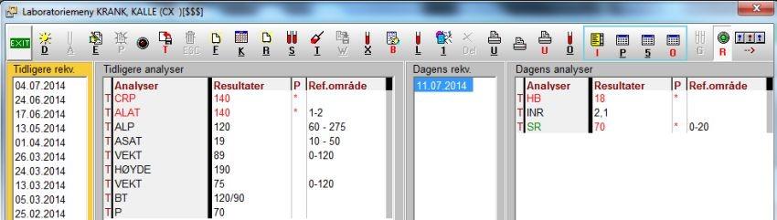 5 Vise analysens referanseområde Trykk Ctrl+R dersom du ønsker å se referanseområdet for hver analyse i