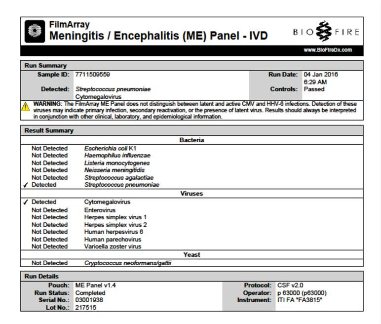 ME panelet Bakterier: Escherichia coli K1 Haemophilus influenzae Listeria monocytogenes