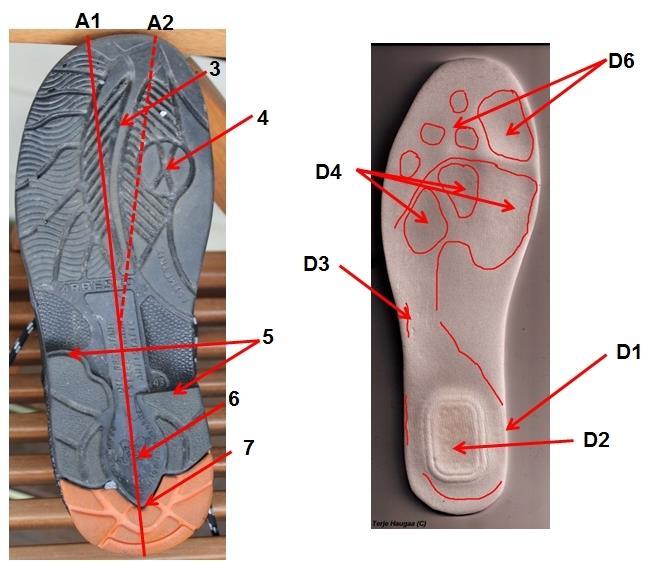 Det mest sentrale er gel pad i hælområdet som gir feilbelastning på hælen (konsentrert trykk), noe som kan gi hælsmerter.