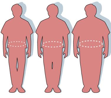 Hva er overvekt? Kroppsmasseindeks Normalvektig 18.5-24.9 Overvektig 25.0-29.9 Fedme grad 1 30.0-34.9 Fedme grad 2 35.0-39.