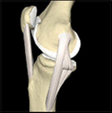 INNLEIING Kneleddet består av 2 hovedledd: Det som blir kalla kneleddet, mellom lårbeinet og leggbeinet, og i llegg leddet mellom patella (kneskjelet) og gropa for l på lårbeinet.