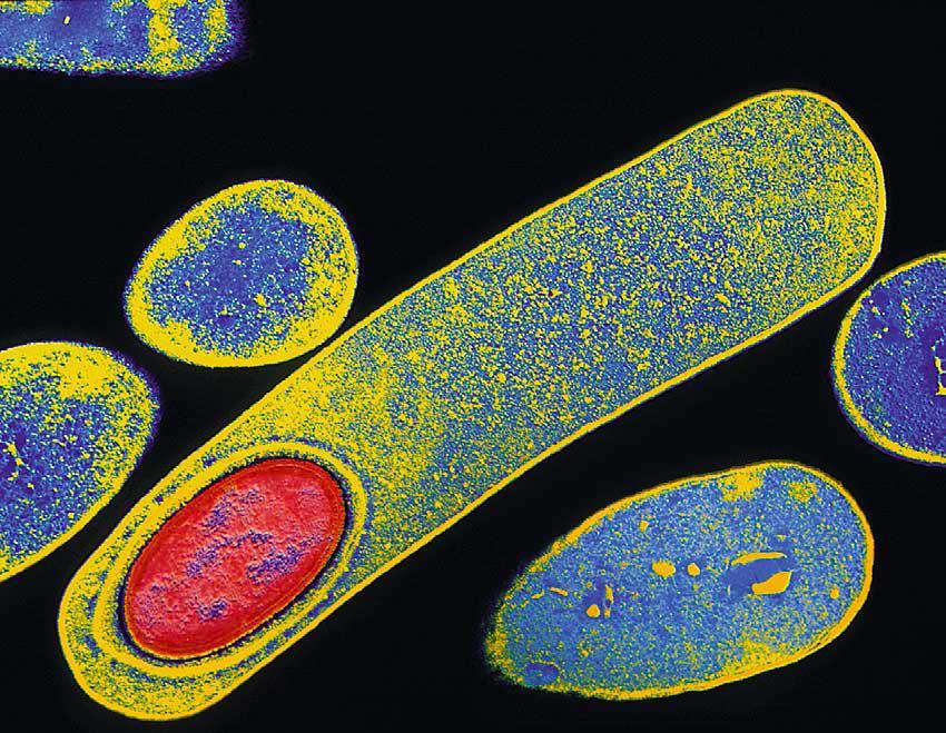 Disposisjon Mikrobiologi Sykdom - CDI Diagnostiske utfordringer Epidemiologiske utfordringer Smittevern utfordringer Anbefalinger