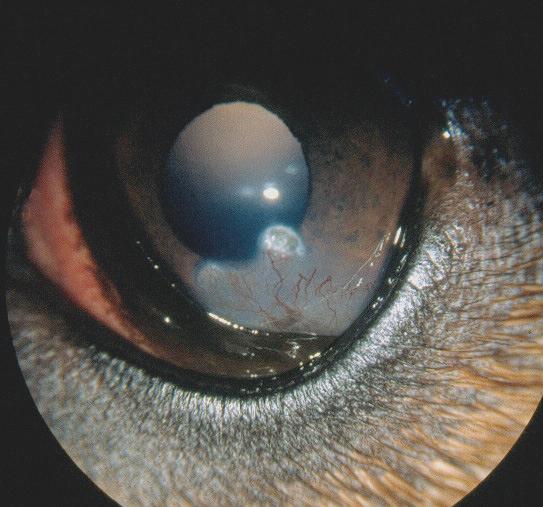 forekommer blant annet etter bulbusprolaps hvis n.oftalmicus som er en gren av trigeminusnerven skades.